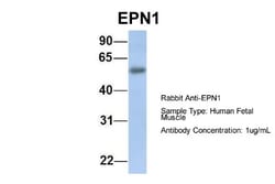 Epsin 1 Antibody, Novus Biologicals 100&mu;L; Unlabeled:Antibodies, Polyclonal