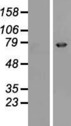 Novus Biologicals™ Epsin 3 Overexpression Lysate
