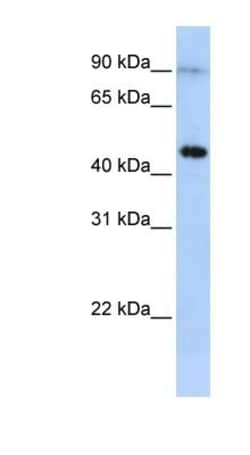 EPX Antibody, Novus Biologicals 0.05mg; Unlabeled:Antibodies, Polyclonal