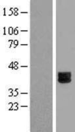 Novus Biologicals&trade;&nbsp;DSPG3/EPYC Overexpression Lysate
