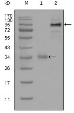ETV1 Antibody (1C8B6), Novus Biologicals 0.1mL; Unlabeled:Antibodies, Monoclonal