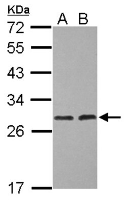 ERAB Antibody, Novus Biologicals 0.1 mL | Buy Online | Novus Biologicals | Fisher Scientific