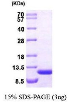 Novus Biologicals&trade;&nbsp;Recombinant Human ERAF Protein