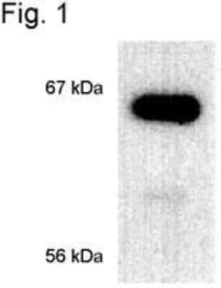 ER alpha/NR3A1 Antibody (33), Novus Biologicals:Antibodies:Primary Antibodies