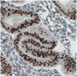 ER alpha/NR3A1 Antibody (CL1196), Novus Biologicals 25 &mu;L | Buy Online | Novus Biologicals | Fisher Scientific