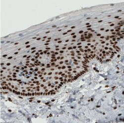 ER alpha/NR3A1 Antibody (CL1196), Novus Biologicals 25 &mu;L | Buy Online | Novus Biologicals | Fisher Scientific