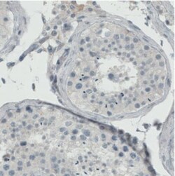 ER alpha/NR3A1 Antibody (CL1196), Novus Biologicals 25 &mu;L | Buy Online | Novus Biologicals | Fisher Scientific