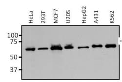 ER alpha/NR3A1 Antibody (EVG F9), Novus Biologicals 0.1mL; Unlabeled:Antibodies,