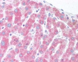Novus Biologicals™ ER Associated Degradation Antibody Pack