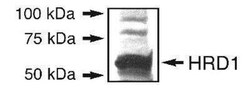 Novus Biologicals ER Associated Degradation Antibody Pack 3 vials:Antibodies