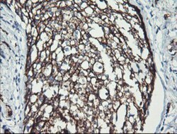 ErbB2/Her2 Antibody (OTI4F10), Novus Biologicals 0.1mL; Unlabeled:Antibodies,