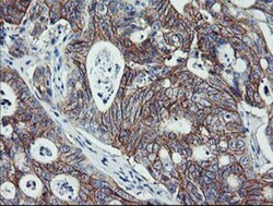ErbB2/Her2 Antibody (OTI4F10), Novus Biologicals 0.1mL; Unlabeled:Antibodies,