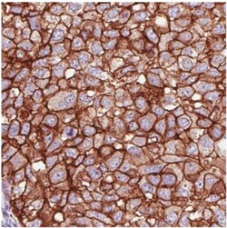 ErbB2/Her2 Antibody (CL0269), Novus Biologicals 0.1mL; Unlabeled:Antibodies,