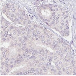 ErbB2/Her2 Antibody (CL0269), Novus Biologicals 0.1mL; Unlabeled:Antibodies,