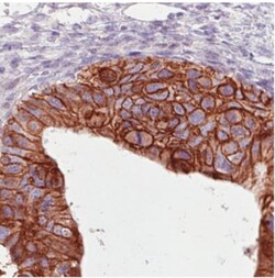 ErbB2/Her2 Antibody (CL0269), Novus Biologicals 0.1mL; Unlabeled:Antibodies,