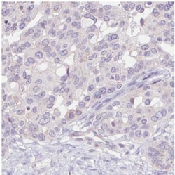 ErbB2/Her2 Antibody (CL0269), Novus Biologicals 0.1mL; Unlabeled:Antibodies,