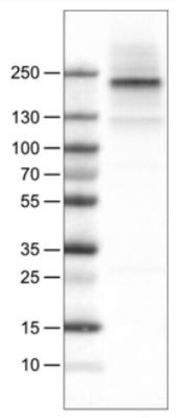 ErbB2/Her2 Antibody (CL0269), Novus Biologicals 0.1mL; Unlabeled:Antibodies,