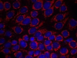 ErbB2/Her2 Antibody, Novus Biologicals:Antibodies:Primary Antibodies