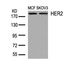 ErbB2/Her2 Antibody, Novus Biologicals:Antibodies:Primary Antibodies
