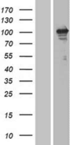 Novus Biologicals&trade;&nbsp;ErbB3/Her3 Overexpression Lysate