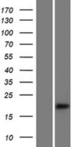 Novus Biologicals&trade;&nbsp;ErbB3/Her3 Overexpression Lysate