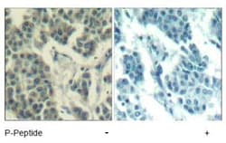 ErbB3/Her3, p Tyr1328 Antibody, Novus Biologicals 0.1 mL | Buy Online | Novus Biologicals | Fisher Scientific
