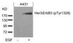 ErbB3/Her3, p Tyr1328 Antibody, Novus Biologicals 0.1 mL | Buy Online | Novus Biologicals | Fisher Scientific