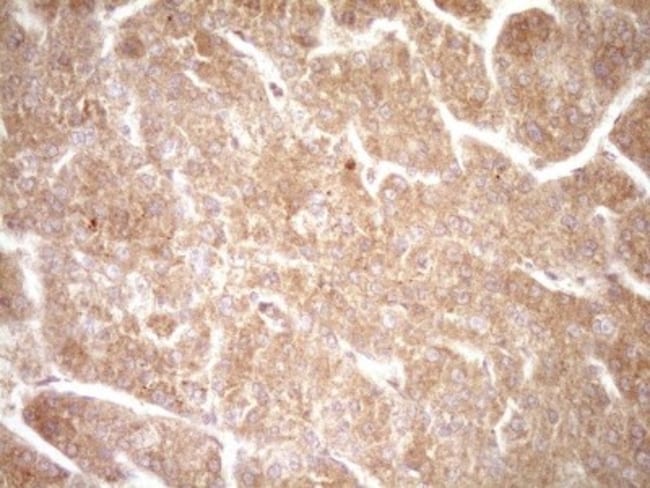 ErbB3/Her3 Antibody (OTI3E10), Novus Biologicals™ 0.1mL; Unlabeled