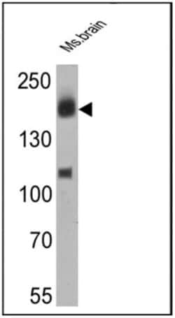 ErbB4/Her4 Antibody (H4.77.16 (Ab77)), Novus Biologicals 0.1mL; Unlabeled:Antibodies,