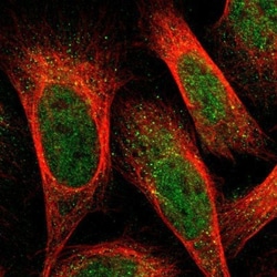 ErbB4/Her4 Antibody, Novus Biologicals 0.1mL; Unlabeled:Antibodies, Polyclonal