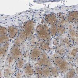 ErbB4/Her4 Antibody, Novus Biologicals 0.1mL; Unlabeled:Antibodies, Polyclonal