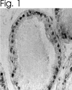 ER beta/NR3A2 Antibody, Novus Biologicals 0.05mg; Unlabeled:Antibodies,