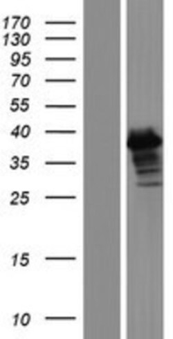 Novus Biologicals&trade;&nbsp;ERCC1 Overexpression Lysate