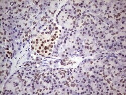 ERCC1 Antibody (OTI2H1), Novus Biologicals 0.1mL; Unlabeled:Antibodies,