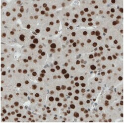 ERCC1 Antibody (CL1249), Novus Biologicals 0.1mL; Unlabeled:Antibodies,