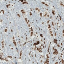ERCC1 Antibody (CL1249), Novus Biologicals 0.1mL; Unlabeled:Antibodies,