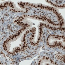 ERCC1 Antibody (CL1249), Novus Biologicals 0.1mL; Unlabeled:Antibodies,