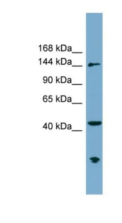 ERCC6L Antibody, Novus Biologicals 100&mu;L; Unlabeled:Antibodies, Polyclonal