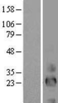 Novus Biologicals&trade;&nbsp;Epiregulin Overexpression Lysate
