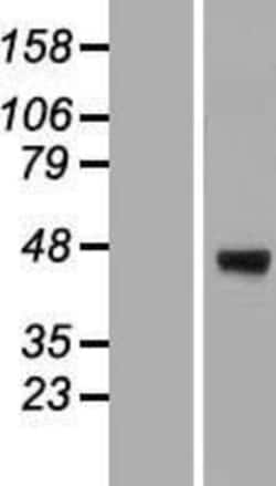 Novus Biologicals&trade;&nbsp;ERGI3 Overexpression Lysate