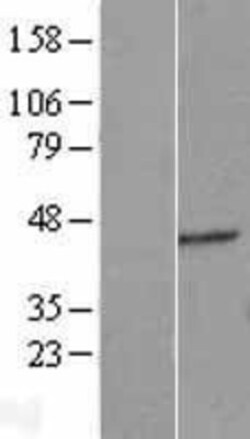 Novus Biologicals&trade;&nbsp;ERGIC2 Overexpression Lysate