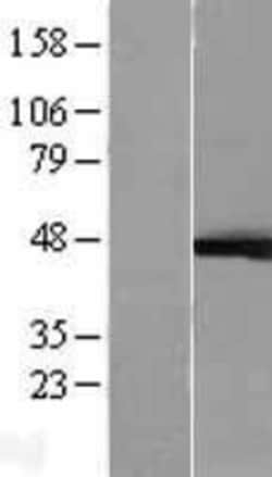 Novus Biologicals&trade;&nbsp;ERK1 Overexpression Lysate
