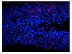 ERK1, p Thr202, p Tyr204 Antibody, Novus Biologicals 0.1mL; Unlabeled:Antibodies,