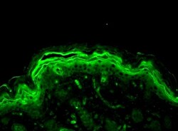 ERK1/2 Antibody, Novus Biologicals 0.1mL; Unlabeled:Antibodies, Polyclonal