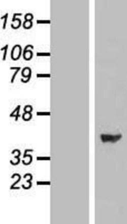 Novus Biologicals&trade;&nbsp;ERK2 Overexpression Lysate