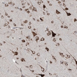 ERLEC1 Antibody, Novus Biologicals 0.1 mL | Buy Online | Novus Biologicals | Fisher Scientific