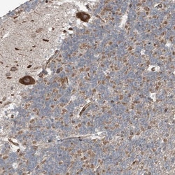 ERLEC1 Antibody, Novus Biologicals 0.1mL; Unlabeled:Antibodies, Polyclonal