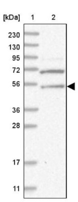 ERLEC1 Antibody, Novus Biologicals 0.1 mL | Buy Online | Novus Biologicals | Fisher Scientific