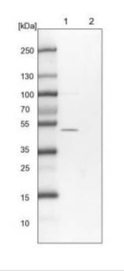 ERLEC1 Antibody, Novus Biologicals 0.1mL; Unlabeled:Antibodies, Polyclonal