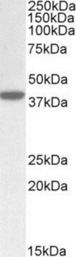 ERLIN1 Antibody, Novus Biologicals 0.1mg; Unlabeled:Antibodies, Polyclonal